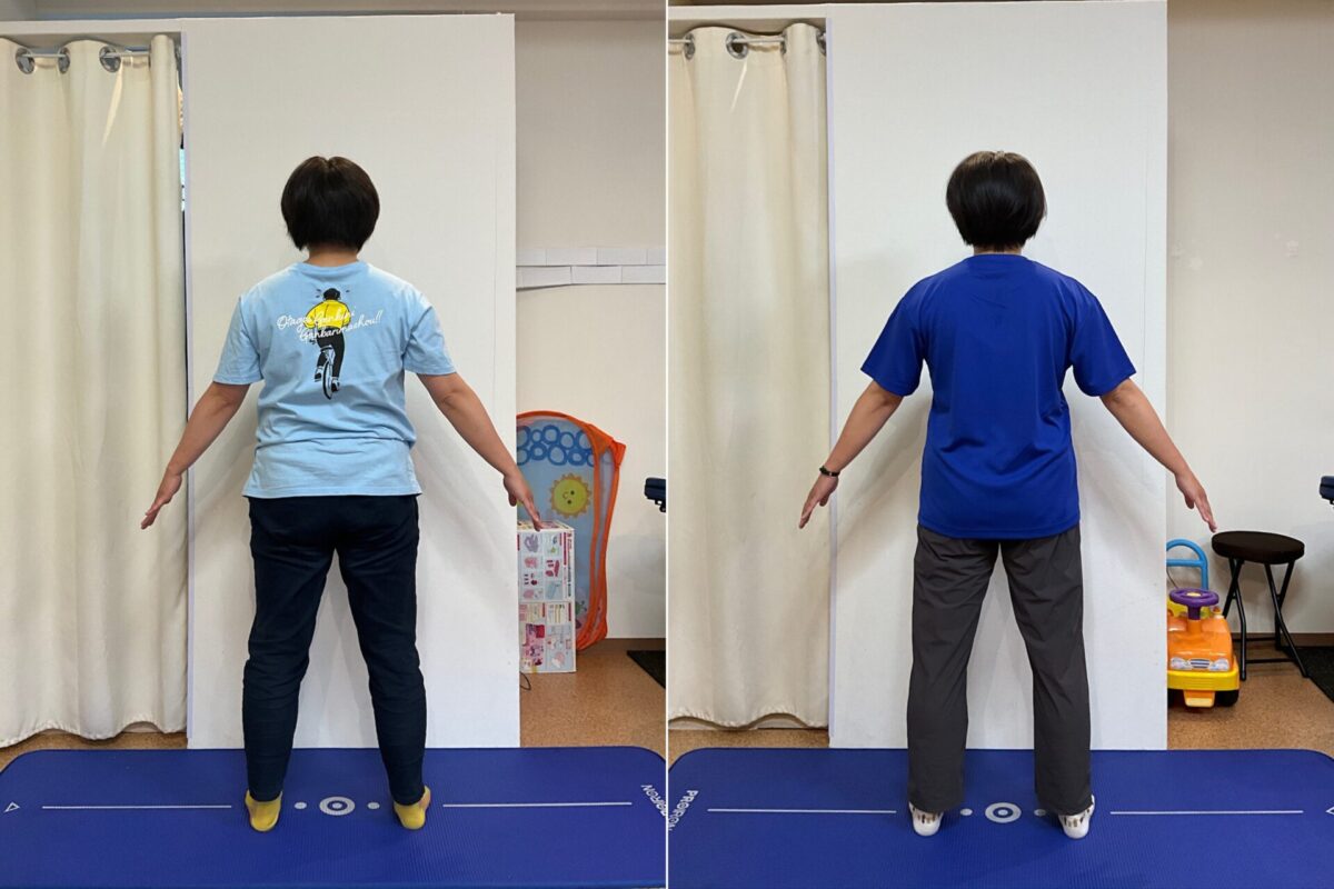 Re:TubeGYMでは前後写真比較を行います。